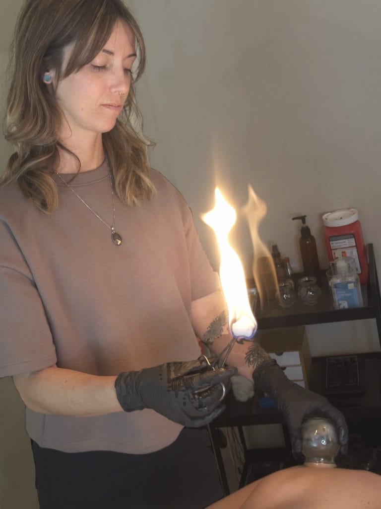 Acupuncturist Jakki Overby prepares for a fire cupping session. A small flame burns from a cotton ball held by tongues and a specialized glass cup is ready to be used.