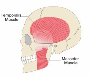 a diagram of the muscles of the head including the temporalis muscle and masseter muscle.